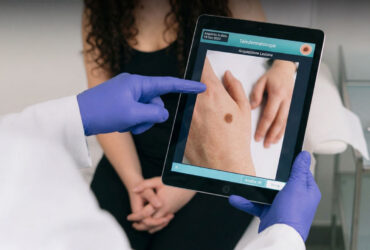 Teledermatologia